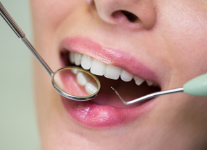 The Gleneagles Hotel